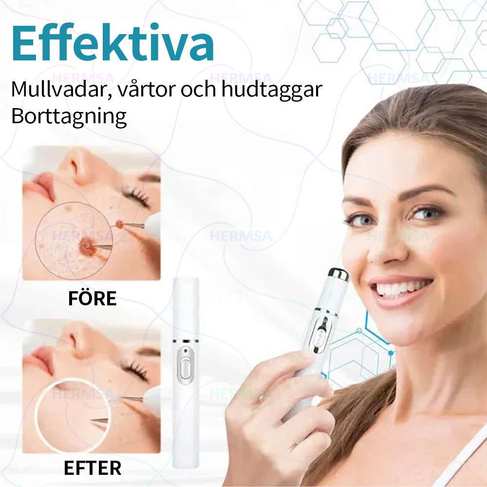 Hermsa® icke-invasiv laserskalare - avlägsnande av ben och vårtor (🔥Sista dagen 80% rabatt)