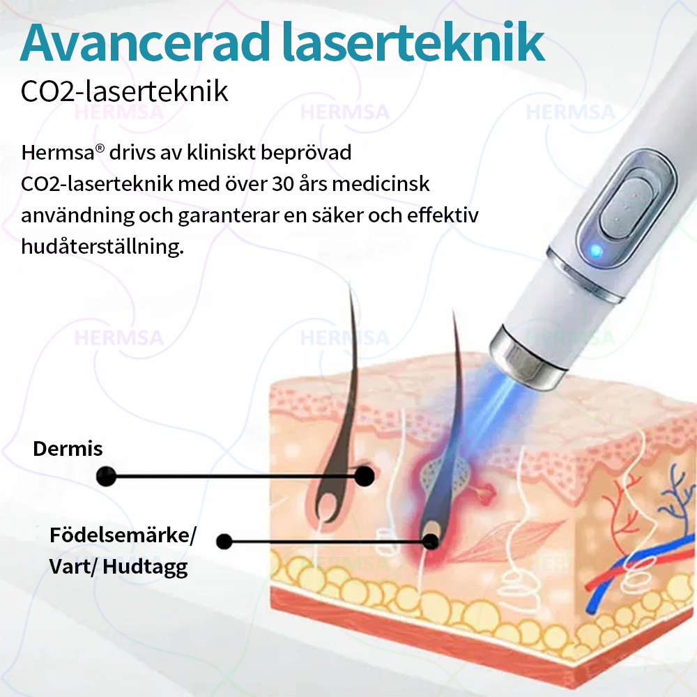 Hermsa® icke-invasiv laserskalare - avlägsnande av ben och vårtor (🔥Sista dagen 80% rabatt)