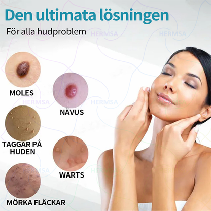 Hermsa® icke-invasiv laserskalare - avlägsnande av ben och vårtor (🔥Sista dagen 80% rabatt)